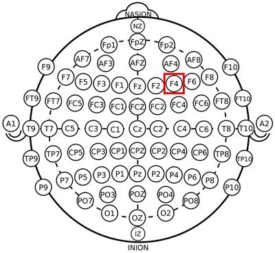 Does rDLPFC activity alter trust? Evidence from a tDCS study